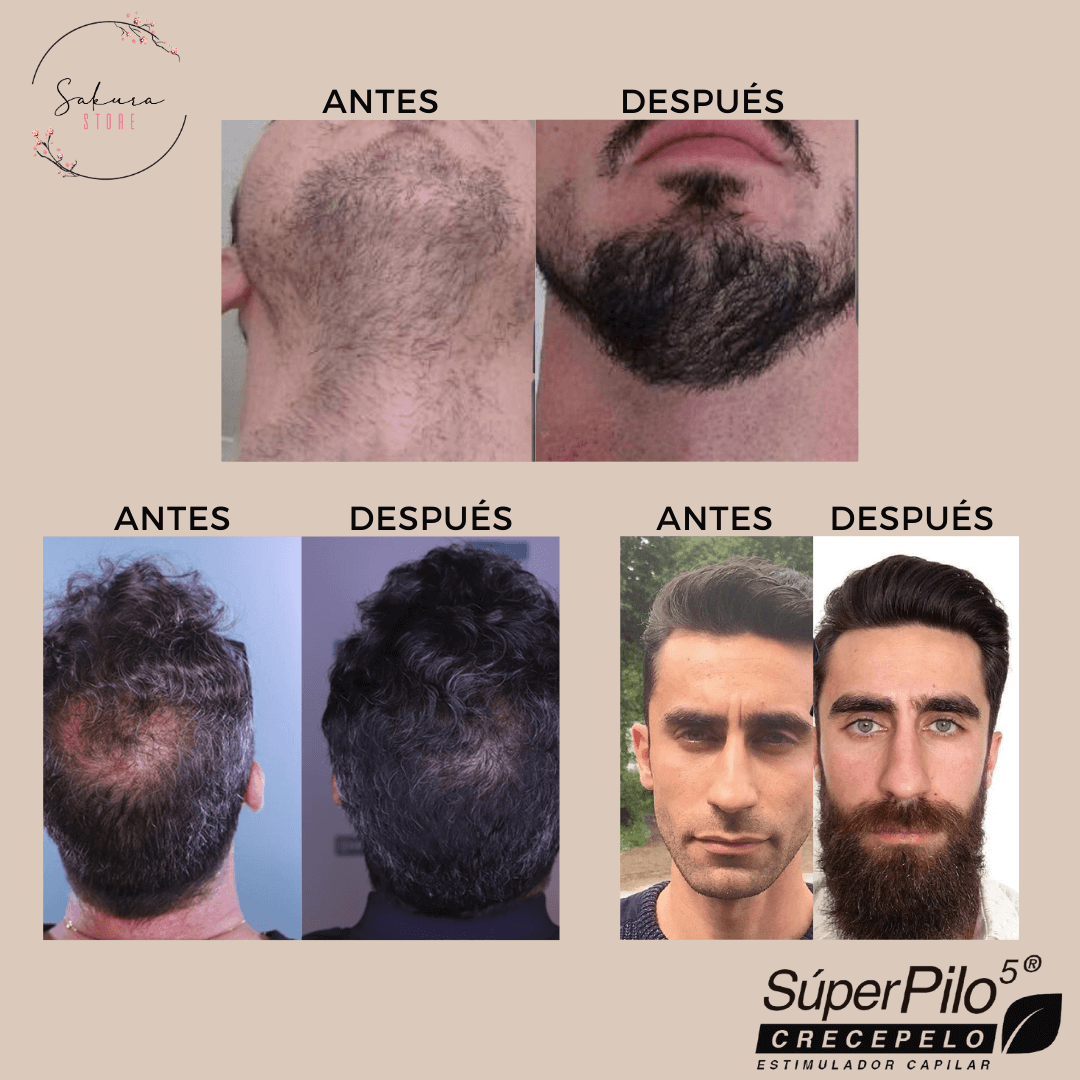 Kit Shampoo y Tónico para el crecimiento - Superpilo