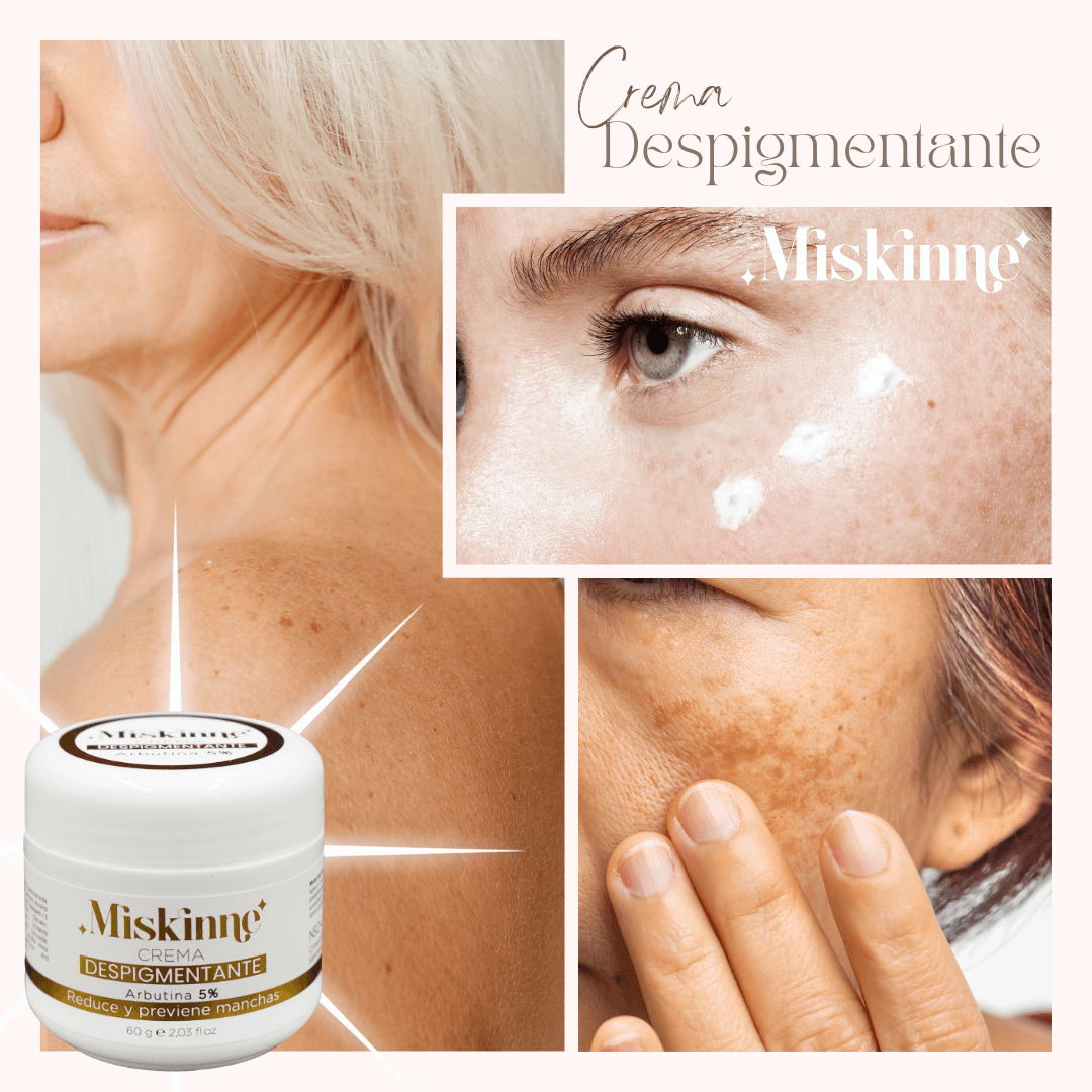 Crema Despigmentante - Miskinne