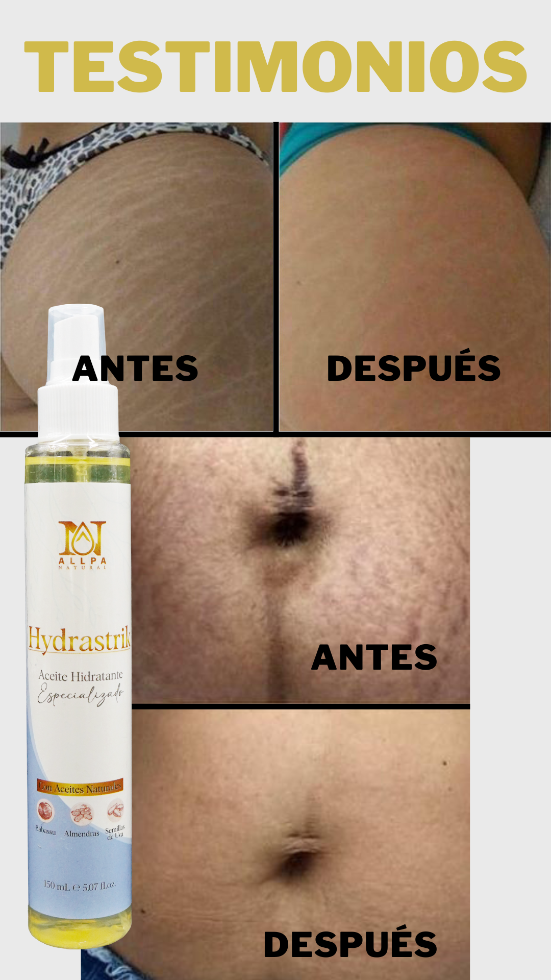 Aceite Antiestrías - Alppa