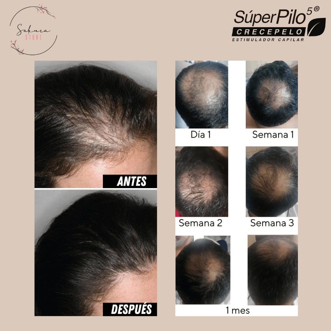 Kit Shampoo y Tónico para el crecimiento - Superpilo