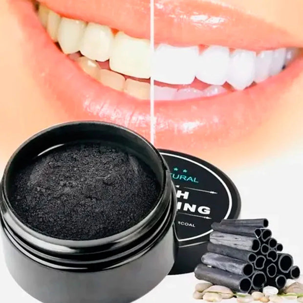 Blanqueamiento dental - Teeth Whitening