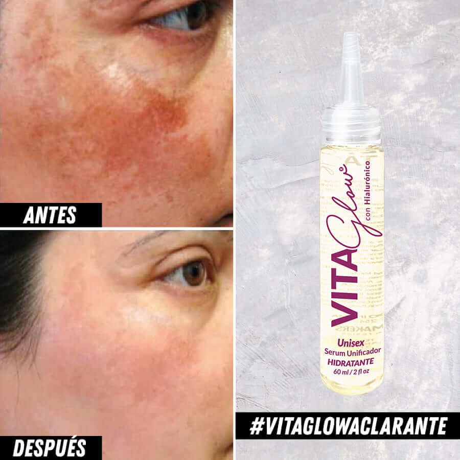 Serum aclarante con hialurónico -  Vitaglow