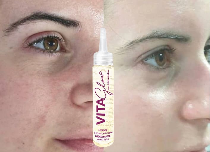 Serum aclarante con hialurónico -  Vitaglow