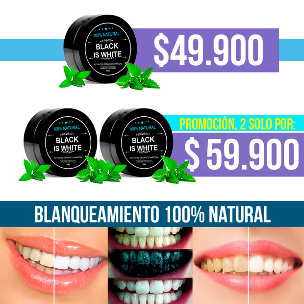 Blanqueamiento dental - Teeth Whitening