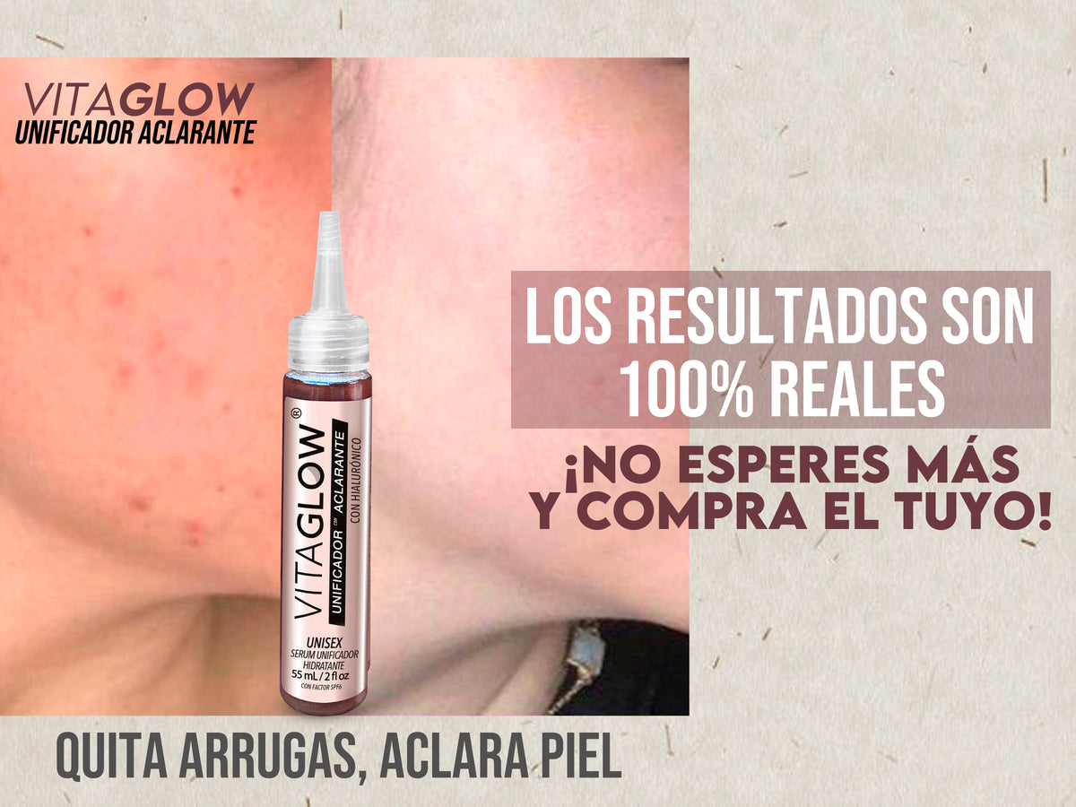 Serum aclarante con hialurónico -  Vitaglow