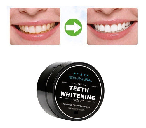 Blanqueamiento dental - Teeth Whitening