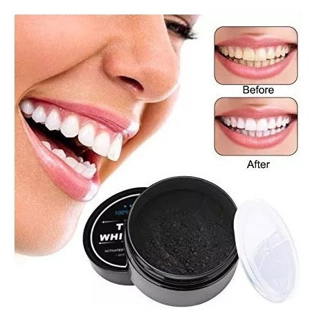 Blanqueamiento dental - Teeth Whitening