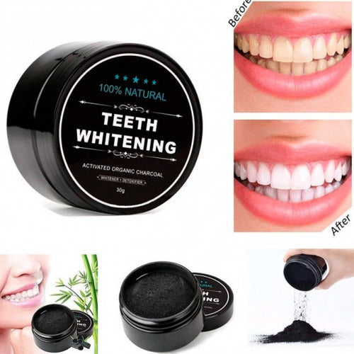 Blanqueamiento dental - Teeth Whitening
